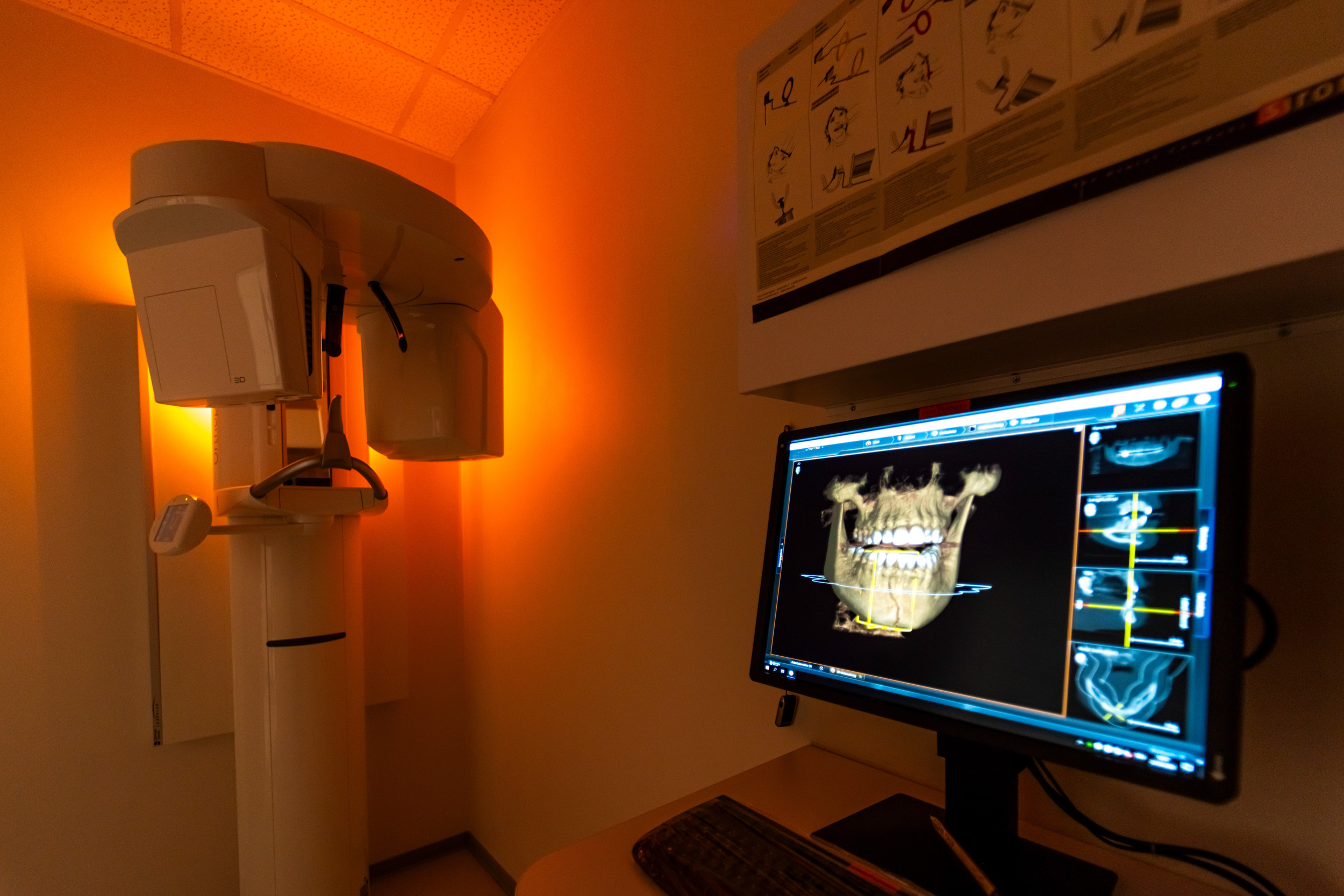 3d röntgen zahnarzt, röntgenbild zähne, zähne röntgen, röntgen zähne, röntgen zähne, 3d-röntgen zahnarzt kosten krankenkasse, 3d röntgen, 3d röntgen zahnarzt kosten, kosten 3d röntgen zahnarzt, röntgen digital zahnarzt, digitale röntgen zahnarzt,
